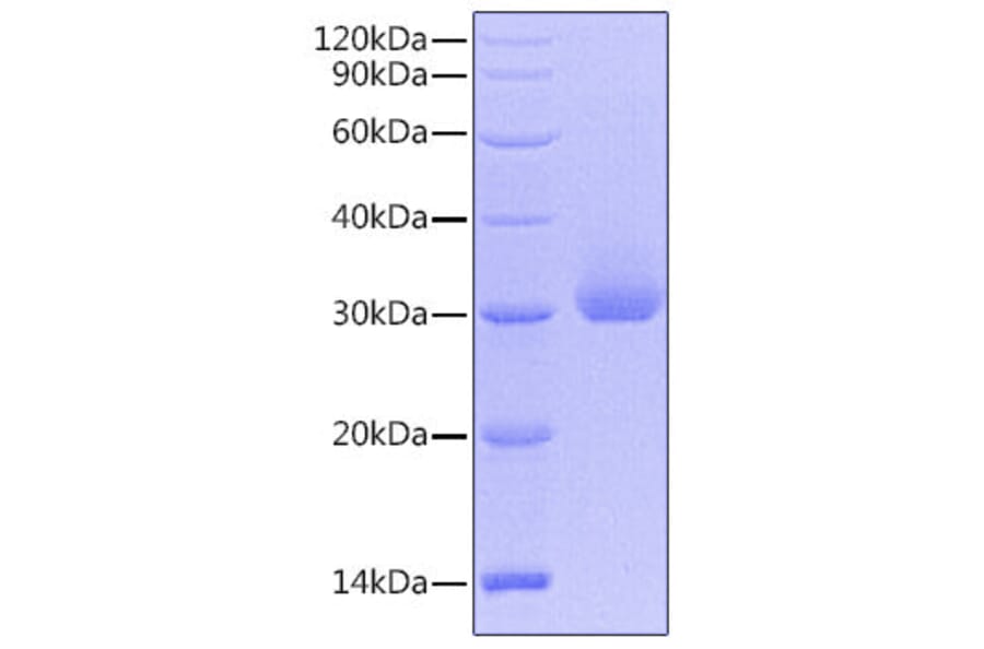 SDS-PAGE - Recombinant Human Kallikrein 4 Protein (C-terminal His Tag) (A330962) - Antibodies.com