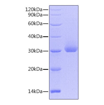 SDS-PAGE - Recombinant Human Kallikrein 4 Protein (C-terminal His Tag) (A330962) - Antibodies.com