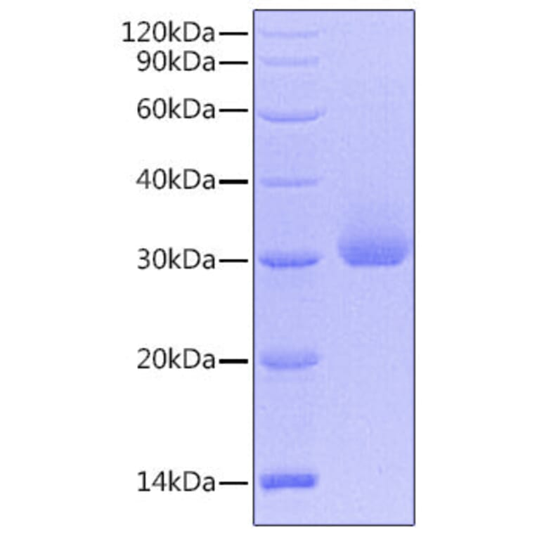 SDS-PAGE - Recombinant Human Kallikrein 4 Protein (C-terminal His Tag) (A330962) - Antibodies.com