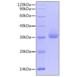 SDS-PAGE - Recombinant Human Kallikrein 4 Protein (C-terminal His Tag) (A330962) - Antibodies.com