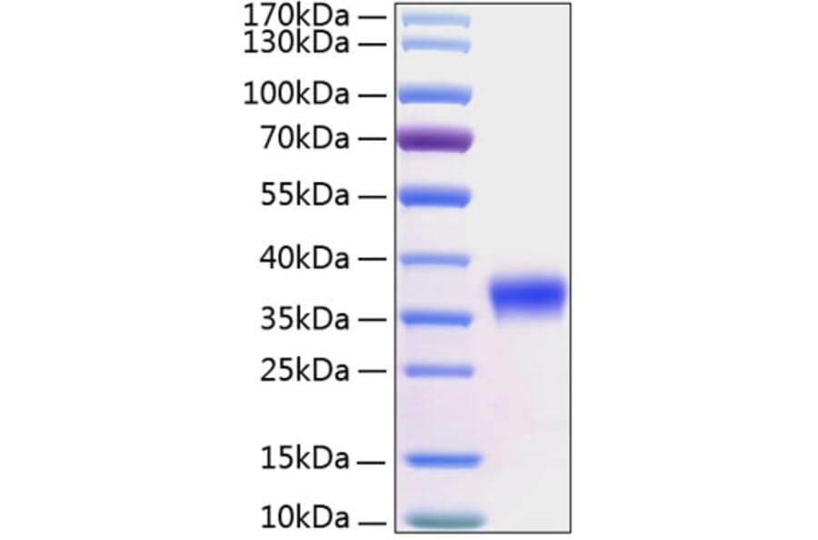 SDS-PAGE - Recombinant Human Kallikrein 8/KLK8 Protein (C-terminal His Tag) (A330963) - Antibodies.com