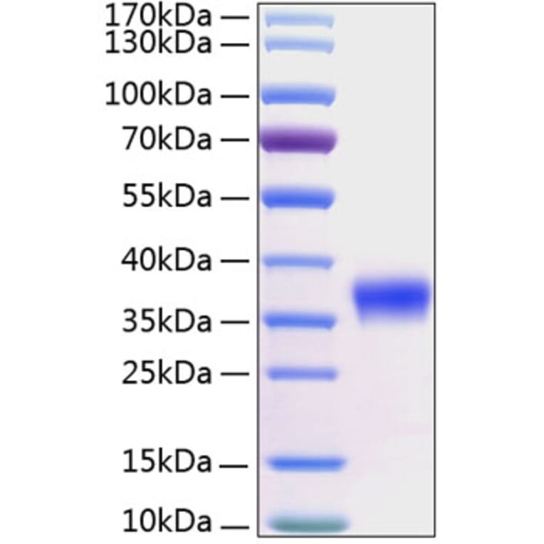 SDS-PAGE - Recombinant Human Kallikrein 8/KLK8 Protein (C-terminal His Tag) (A330963) - Antibodies.com