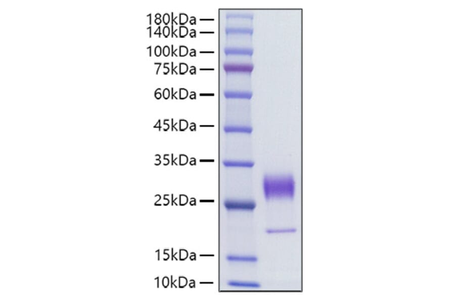 SDS-PAGE - Recombinant Human KGF Protein (C-terminal His Tag) (A330964) - Antibodies.com