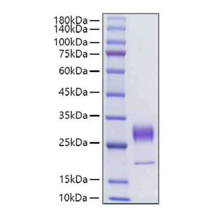 SDS-PAGE - Recombinant Human KGF Protein (C-terminal His Tag) (A330964) - Antibodies.com