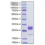 SDS-PAGE - Recombinant Human KGF Protein (C-terminal His Tag) (A330964) - Antibodies.com