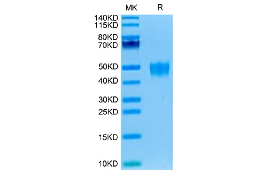 Tris-Bis PAGE - Recombinant Human KI2LA Protein (C-terminal His and Avi Tag) (A330965) - Antibodies.com