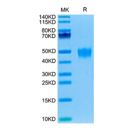 Tris-Bis PAGE - Recombinant Human KI2LA Protein (C-terminal His and Avi Tag) (A330965) - Antibodies.com