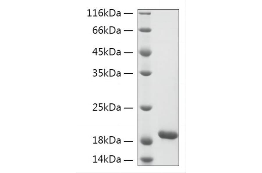 SDS-PAGE - Recombinant Human KIAA0101 Protein (N-terminal His Tag) (A330966) - Antibodies.com
