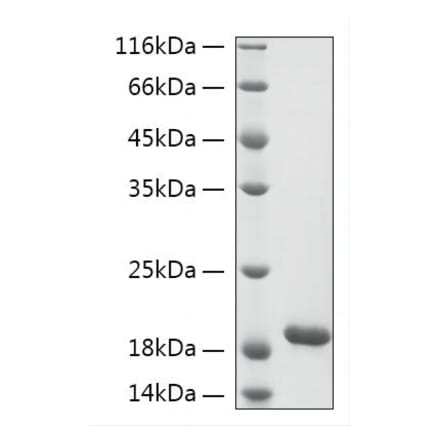 SDS-PAGE - Recombinant Human KIAA0101 Protein (N-terminal His Tag) (A330966) - Antibodies.com