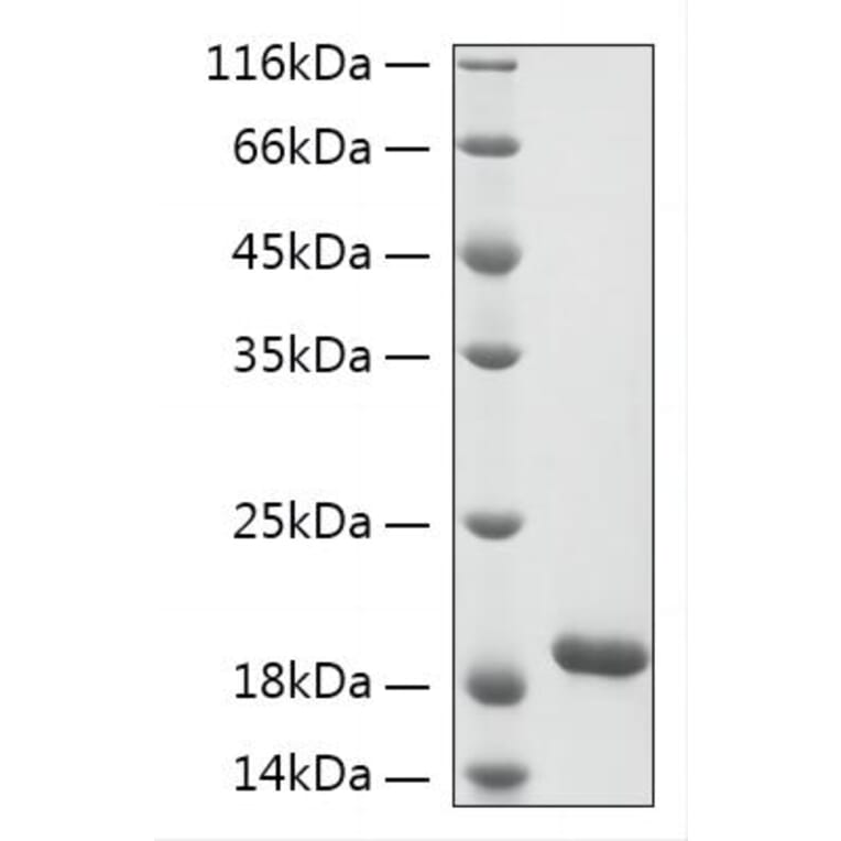SDS-PAGE - Recombinant Human KIAA0101 Protein (N-terminal His Tag) (A330966) - Antibodies.com