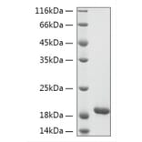 SDS-PAGE - Recombinant Human KIAA0101 Protein (N-terminal His Tag) (A330966) - Antibodies.com