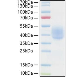 SDS-PAGE - Recombinant Human KIR2DL1 Protein (C-terminal His and Avi Tag) (A330967) - Antibodies.com