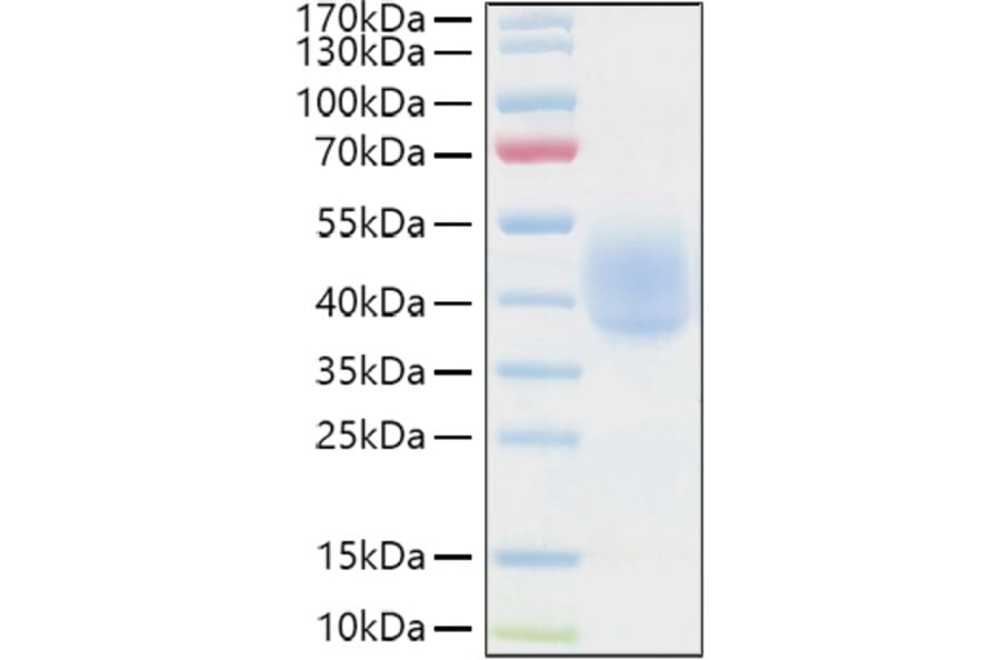 SDS-PAGE - Recombinant Human KIR2DL1 Protein (C-terminal His and Avi Tag) (A330967) - Antibodies.com