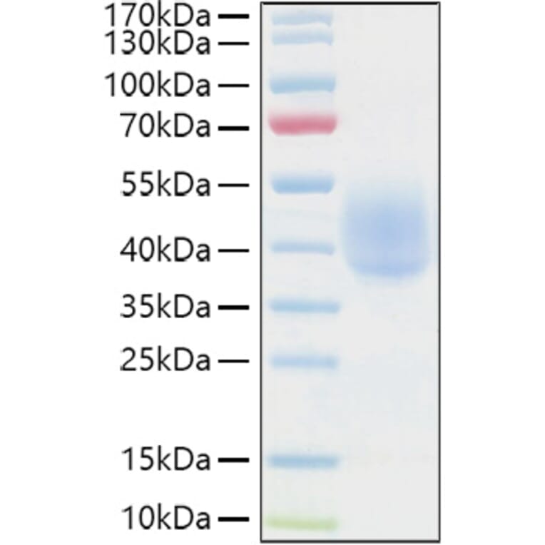 SDS-PAGE - Recombinant Human KIR2DL1 Protein (C-terminal His and Avi Tag) (A330967) - Antibodies.com