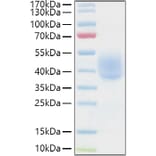 SDS-PAGE - Recombinant Human KIR2DL1 Protein (C-terminal His and Avi Tag) (A330967) - Antibodies.com
