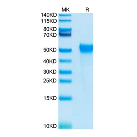Tris-Bis PAGE - Recombinant Human KIR2DL2 Protein (Biotin) (C-terminal His and Avi Tag) (A330968) - Antibodies.com