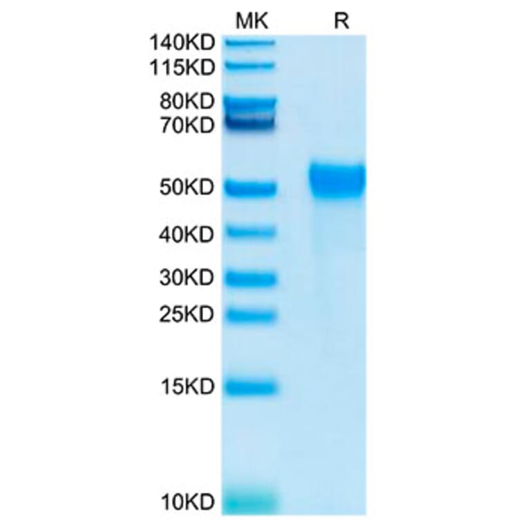 Tris-Bis PAGE - Recombinant Human KIR2DL2 Protein (Biotin) (C-terminal His and Avi Tag) (A330968) - Antibodies.com