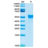 Tris-Bis PAGE - Recombinant Human KIR2DL2 Protein (Biotin) (C-terminal His and Avi Tag) (A330968) - Antibodies.com