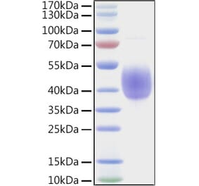 SDS-PAGE - Recombinant Human KIR2DL2 Protein (C-terminal His and Avi Tag) (A330969) - Antibodies.com