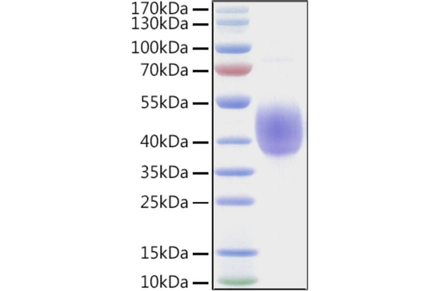 SDS-PAGE - Recombinant Human KIR2DL2 Protein (C-terminal His and Avi Tag) (A330969) - Antibodies.com
