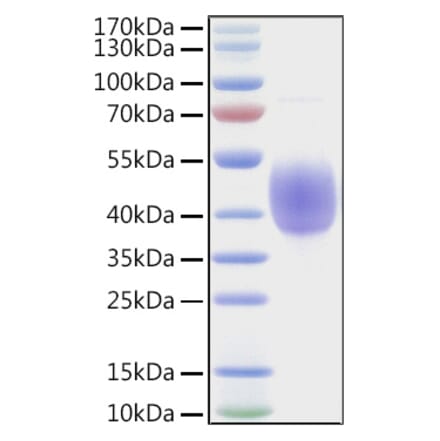 SDS-PAGE - Recombinant Human KIR2DL2 Protein (C-terminal His and Avi Tag) (A330969) - Antibodies.com