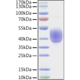 SDS-PAGE - Recombinant Human KIR2DL2 Protein (C-terminal His and Avi Tag) (A330969) - Antibodies.com