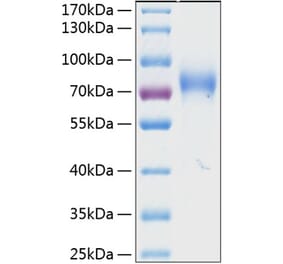 SDS-PAGE - Recombinant Human KIR2DL3 Protein (C-terminal Human Fc and His Tag) (A330970) - Antibodies.com
