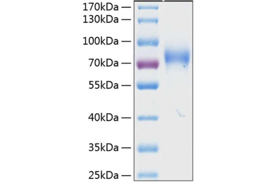 SDS-PAGE - Recombinant Human KIR2DL3 Protein (C-terminal Human Fc and His Tag) (A330970) - Antibodies.com