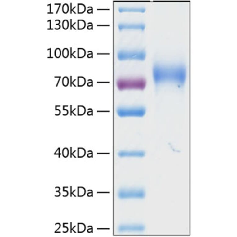 SDS-PAGE - Recombinant Human KIR2DL3 Protein (C-terminal Human Fc and His Tag) (A330970) - Antibodies.com
