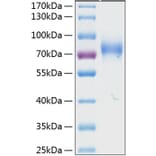 SDS-PAGE - Recombinant Human KIR2DL3 Protein (C-terminal Human Fc and His Tag) (A330970) - Antibodies.com