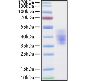 SDS-PAGE - Recombinant Human KIR2DL3 Protein (C-terminal His Tag) (A330971) - Antibodies.com