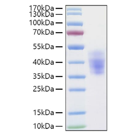 SDS-PAGE - Recombinant Human KIR2DL3 Protein (C-terminal His Tag) (A330971) - Antibodies.com