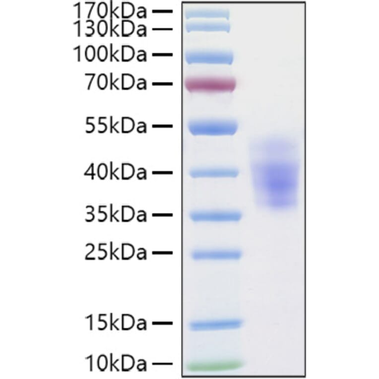 SDS-PAGE - Recombinant Human KIR2DL3 Protein (C-terminal His Tag) (A330971) - Antibodies.com
