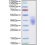 SDS-PAGE - Recombinant Human KIR2DL3 Protein (C-terminal His Tag) (A330971) - Antibodies.com