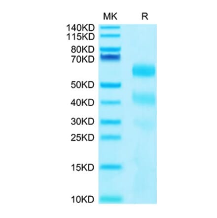 Tris-Bis PAGE - Recombinant Human KIR3DL2 Protein (C-terminal His and Avi Tag) (A330972) - Antibodies.com