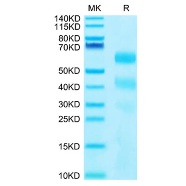 Tris-Bis PAGE - Recombinant Human KIR3DL2 Protein (C-terminal His and Avi Tag) (A330972) - Antibodies.com