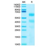 Tris-Bis PAGE - Recombinant Human KIR3DL2 Protein (C-terminal His and Avi Tag) (A330972) - Antibodies.com
