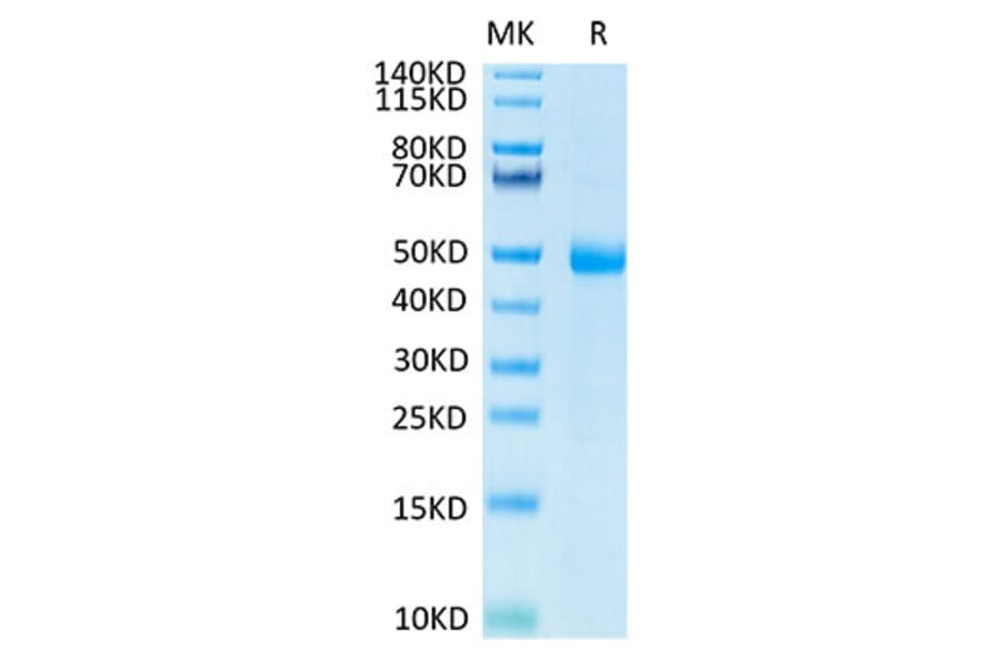Tris-Bis PAGE - Recombinant Human KIR3DL3 Protein (C-terminal His and Avi Tag) (A330973) - Antibodies.com