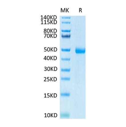 Tris-Bis PAGE - Recombinant Human KIR3DL3 Protein (C-terminal His and Avi Tag) (A330973) - Antibodies.com