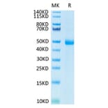 Tris-Bis PAGE - Recombinant Human KIR3DL3 Protein (C-terminal His and Avi Tag) (A330973) - Antibodies.com
