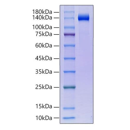 SDS-PAGE - Recombinant human KLB Protein (C-terminal His Tag) (A330974) - Antibodies.com
