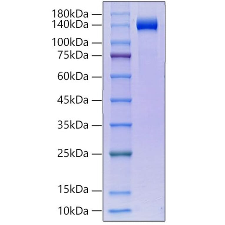 SDS-PAGE - Recombinant human KLB Protein (C-terminal His Tag) (A330974) - Antibodies.com