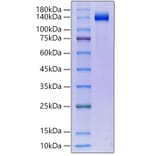 SDS-PAGE - Recombinant human KLB Protein (C-terminal His Tag) (A330974) - Antibodies.com