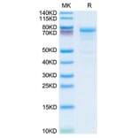 SDS-PAGE - Recombinant Human KLKB1 Protein (C-terminal His Tag) (A330975) - Antibodies.com
