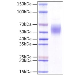 SDS-PAGE - Recombinant Human KLRG1 Protein (N-terminal Rabbit Fc Tag) (A330976) - Antibodies.com