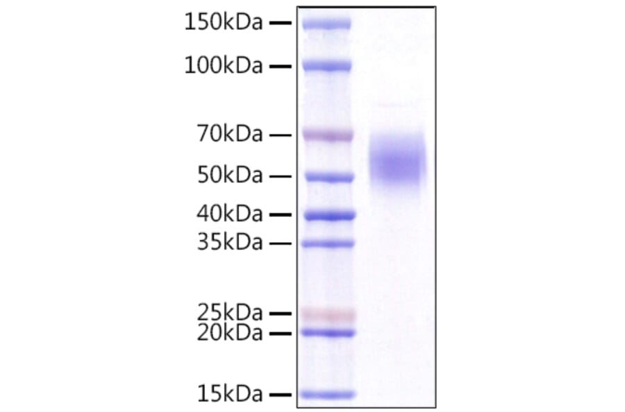 SDS-PAGE - Recombinant Human KLRG1 Protein (N-terminal Rabbit Fc Tag) (A330976) - Antibodies.com