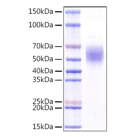 SDS-PAGE - Recombinant Human KLRG1 Protein (N-terminal Rabbit Fc Tag) (A330976) - Antibodies.com