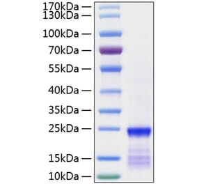 SDS-PAGE - Recombinant Human KRAS Protein (N-terminal His Tag) (A330977) - Antibodies.com