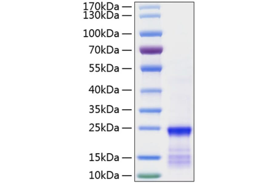 SDS-PAGE - Recombinant Human KRAS Protein (N-terminal His Tag) (A330977) - Antibodies.com