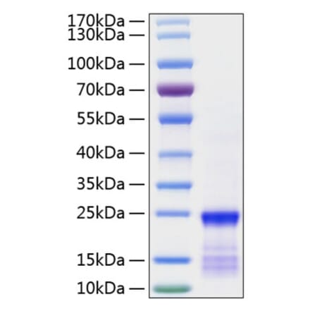 SDS-PAGE - Recombinant Human KRAS Protein (N-terminal His Tag) (A330977) - Antibodies.com